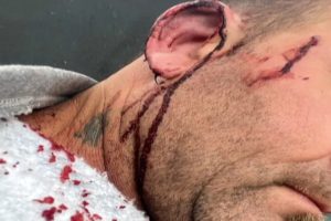 intendente de pueblo brugo golpe